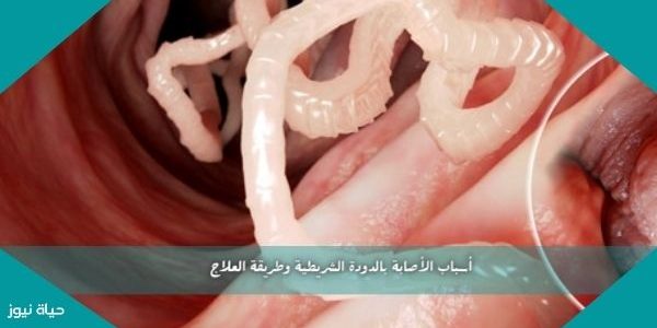 أسباب الأصابة بالدودة الشريطية وطريقة العلاج
