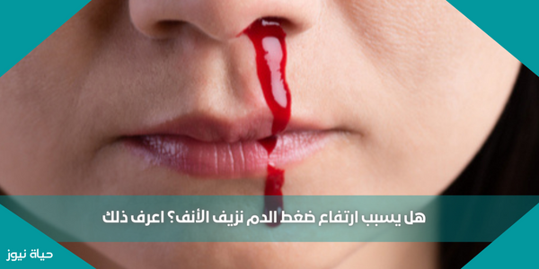 هل يسبب ارتفاع ضغط الدم نزيف الأنف؟ اعرف ذلك