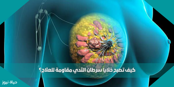 كيف تصبح خلايا سرطان الثدي مقاومة للعلاج؟