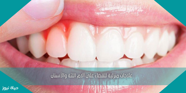 علاجات منزلية للقضاء على آلام اللثة والأسنان